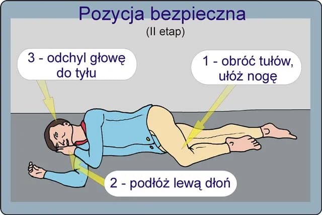 Dlaczego pozycja boczna jest bezpieczna i jak ratuje życie